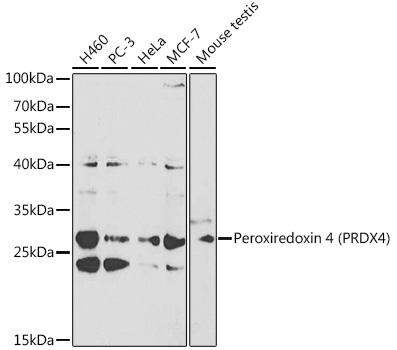 Peroxiredoxin 4 (PRDX4) Rabbit Polyclonal Antibody [KO Validated]