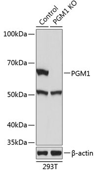 PGM1 Rabbit Polyclonal Antibody [KO Validated]