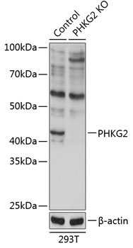 PHKG2 Rabbit Polyclonal Antibody [KO Validated]