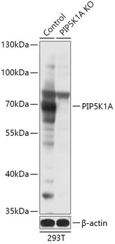 PIP5K1A Rabbit Polyclonal Antibody [KO Validated]