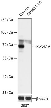 PIP5K1A Rabbit Polyclonal Antibody [KO Validated]