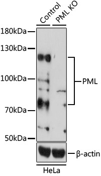 PML Rabbit Polyclonal Antibody [KO Validated]
