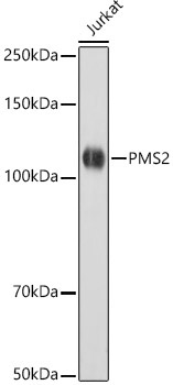 PMS2 Rabbit Monoclonal Antibody [KO Validated]
