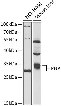 PNP Rabbit Polyclonal Antibody [KO Validated]