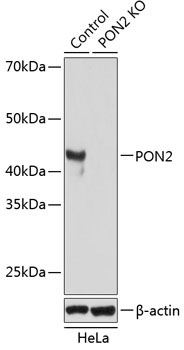 PON2 Rabbit Polyclonal Antibody [KO Validated]