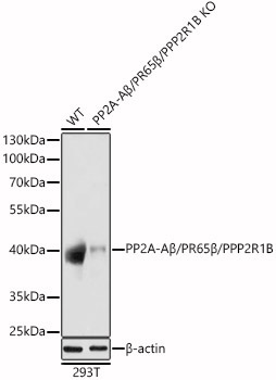PP2A-ABeta/PR65Beta/PPP2R1B Rabbit Polyclonal Antibody [KO Validated]