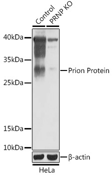 Prion Protein Rabbit Polyclonal Antibody [KO Validated]