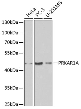 PRKAR1A Rabbit Polyclonal Antibody [KO Validated]