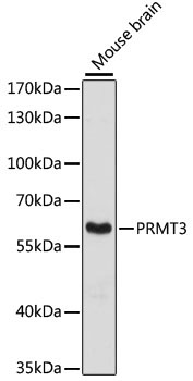 PRMT3 Rabbit Polyclonal Antibody [KO Validated]