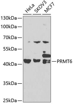 PRMT6 Rabbit Polyclonal Antibody [KO Validated]