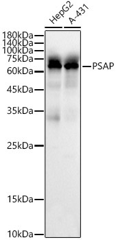 PSAP Rabbit Polyclonal Antibody [KO Validated]