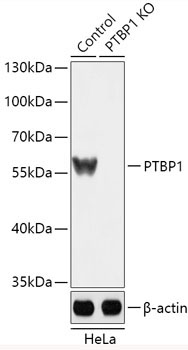 PTBP1 Rabbit Polyclonal Antibody [KO Validated]