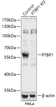 PTBP1 Rabbit Polyclonal Antibody [KO Validated]