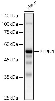 PTPN1 Rabbit Polyclonal Antibody [KO Validated]