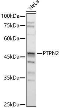 PTPN2 Rabbit Polyclonal Antibody [KO Validated]