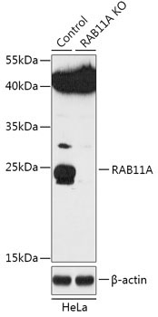 RAB11A Rabbit Polyclonal Antibody [KO Validated]