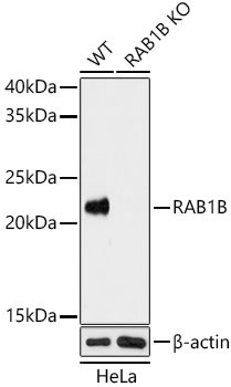 RAB1B Rabbit Polyclonal Antibody [KO Validated]