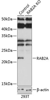 RAB2A Rabbit Polyclonal Antibody [KO Validated]