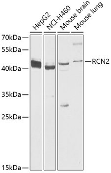 RCN2 Rabbit Polyclonal Antibody [KO Validated]