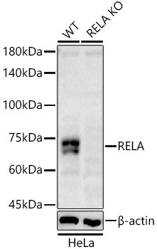 RELA Rabbit Polyclonal Antibody [KO Validated]