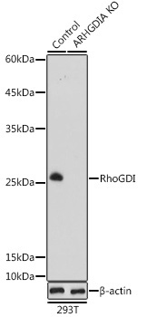 RhoGDI Rabbit Polyclonal Antibody [KO Validated]