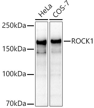 ROCK1 Rabbit Polyclonal Antibody [KO Validated]