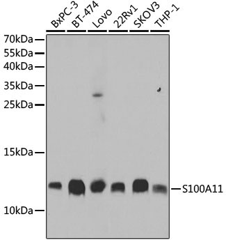 S100A11 Rabbit Polyclonal Antibody [KO Validated]