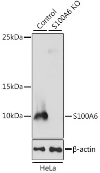 S100A6 Rabbit Polyclonal Antibody [KO Validated]