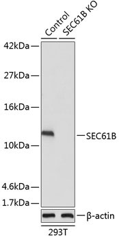 SEC61B Rabbit Polyclonal Antibody [KO Validated]