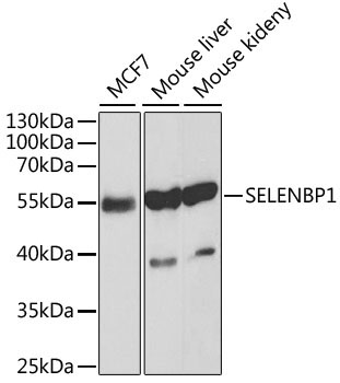 SELENBP1 Rabbit Polyclonal Antibody [KO Validated]