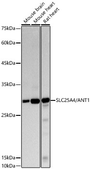 SLC25A4/ANT1 Rabbit Monoclonal Antibody [KO Validated]