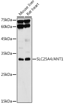 SLC25A4/ANT1 Rabbit Polyclonal Antibody [KO Validated]