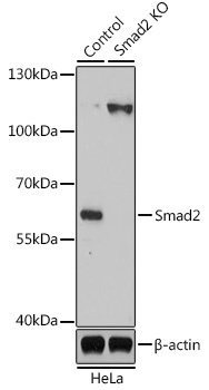 Smad2 Rabbit Polyclonal Antibody [KO Validated]