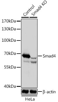 Smad4 Rabbit Polyclonal Antibody [KO Validated]