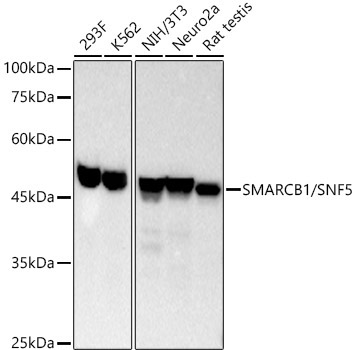 SMARCB1/SNF5 Rabbit Monoclonal Antibody [KO Validated]