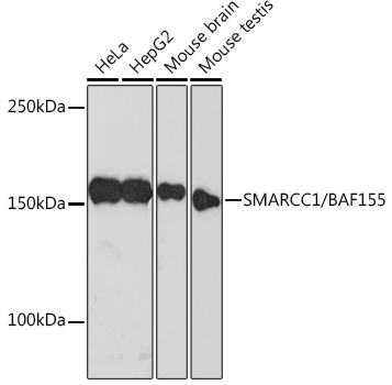 SMARCC1/BAF155 Rabbit Monoclonal Antibody [KO Validated]