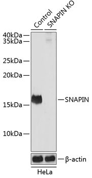 SNAPIN Rabbit Polyclonal Antibody [KO Validated]