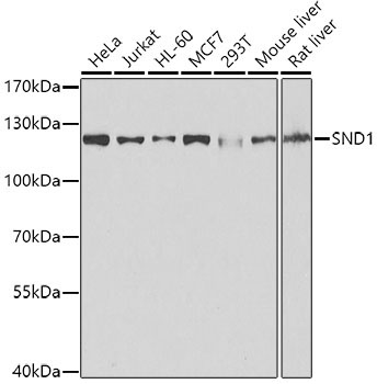 SND1 Rabbit Polyclonal Antibody [KO Validated]