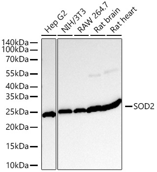 SOD2 Rabbit Monoclonal Antibody [KO Validated]