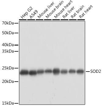 SOD2 Rabbit Polyclonal Antibody [KO Validated]