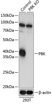 SPK Rabbit Polyclonal Antibody [KO Validated]