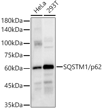SQSTM1/p62 Rabbit Polyclonal Antibody [KO Validated]