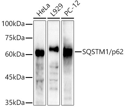 SQSTM1/p62 Rabbit Polyclonal Antibody [KO Validated]
