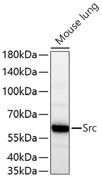 Src Rabbit Monoclonal Antibody [KO Validated]