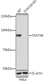 STAT5B Rabbit Monoclonal Antibody [KO Validated]