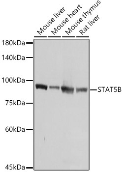 STAT5B Rabbit Polyclonal Antibody [KO Validated]