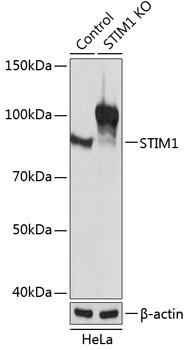 STIM1 Rabbit Polyclonal Antibody [KO Validated]