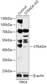 STRADA Rabbit Polyclonal Antibody [KO Validated]