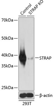 STRAP Rabbit Polyclonal Antibody [KO Validated]