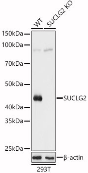 SUCLG2 Rabbit Polyclonal Antibody [KO Validated]